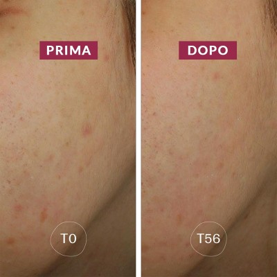 Siero Anti-macchie – Trattamento correttivo bio uniformante | Volo di Fiori EcoBio Distribuzione